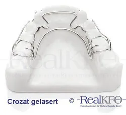 Das Crozat von RealKFO, eine erfolgreiche skelettierte kieferorthopädische Behandlungsapparatur, auf einem Kiefermodell.