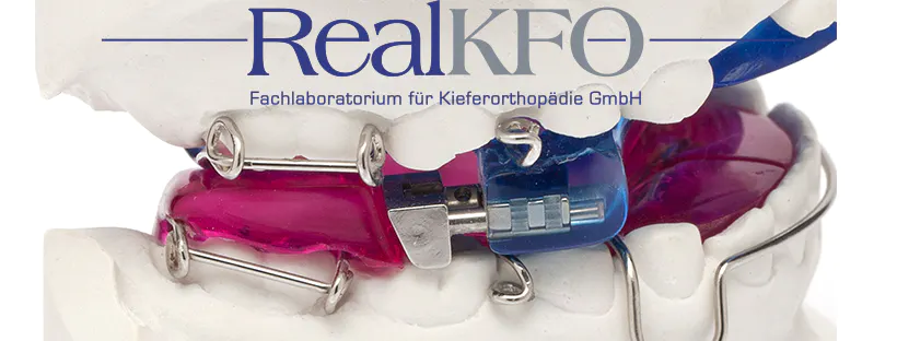 Der Twin Block, eine kieferorthopädische Apparatur, auf einem Kiefermodell hinter dem Logo des RealKFO-Fachlabors für Kieferorthopädie.